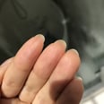 Why You Have Skin Growing Under Your Nails